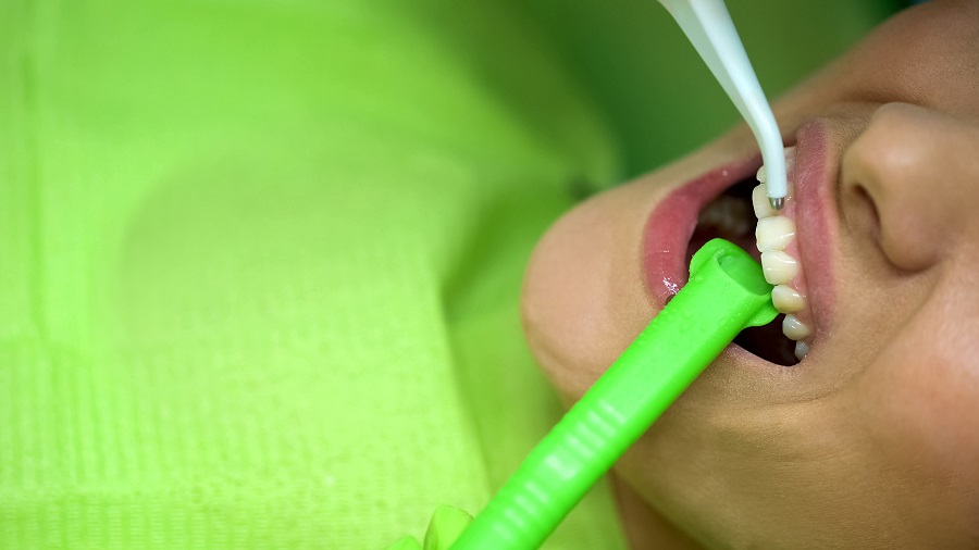 How a General Dentist Fixes Cavities