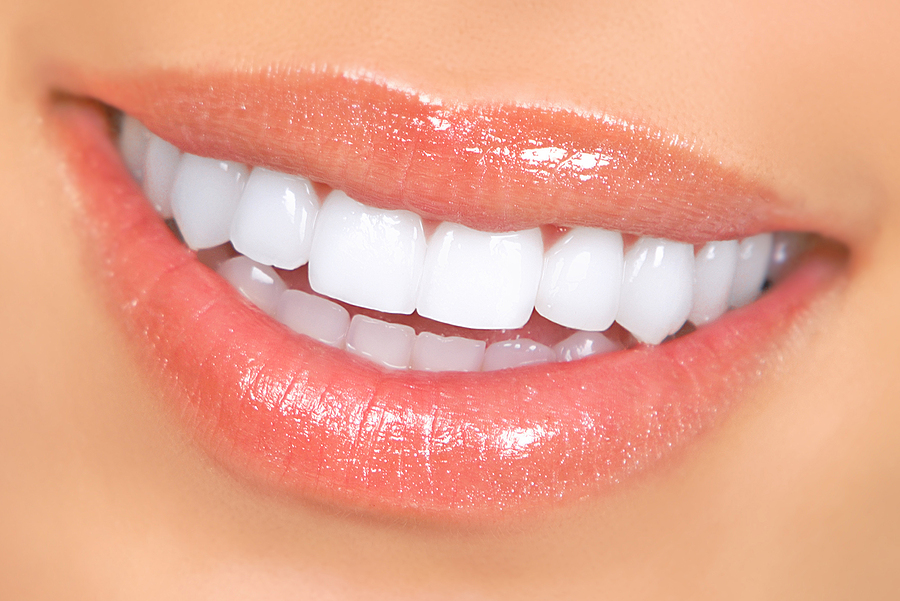 Transform Your Smile with Lumineers in Chesapeake, VA: A Guide to a Radiant Look