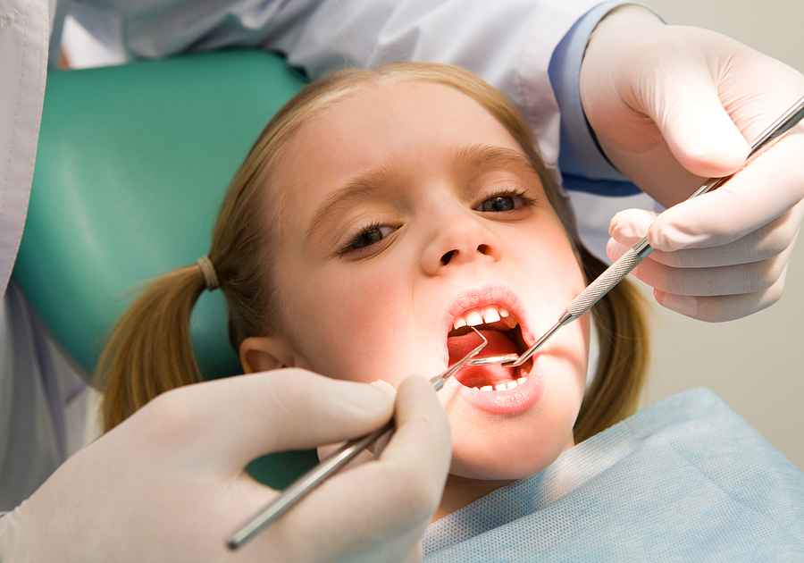 Dental Sealants and Fluoride: A Powerful Duo for Cavity Prevention